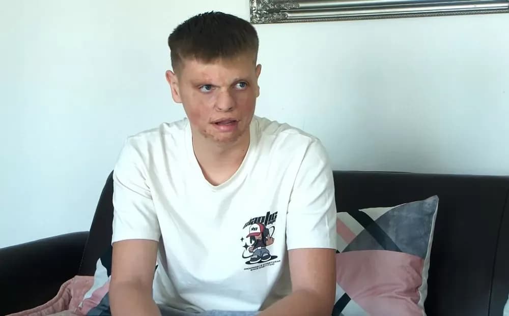 PRIČA O KRISTIJANU - Pomozimo dječaku koji više ne želi skrivati ​​svoje lice