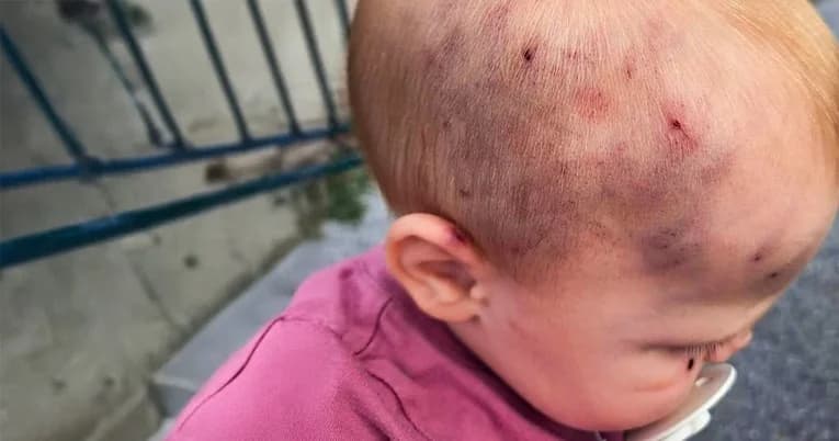 Ravnateljica vrtića iz Slavonskog Broda: ʼVidjela sam sliku, odgojiteljice su upozorene. I dalje rade...ʼ